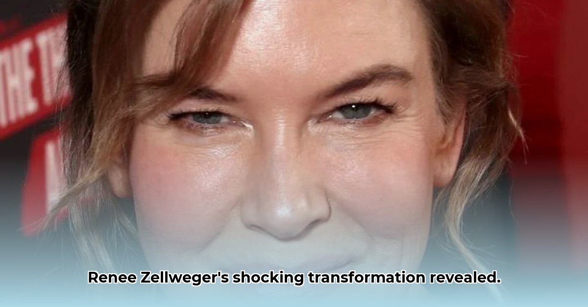 renee-zellweger-plastic-surgery